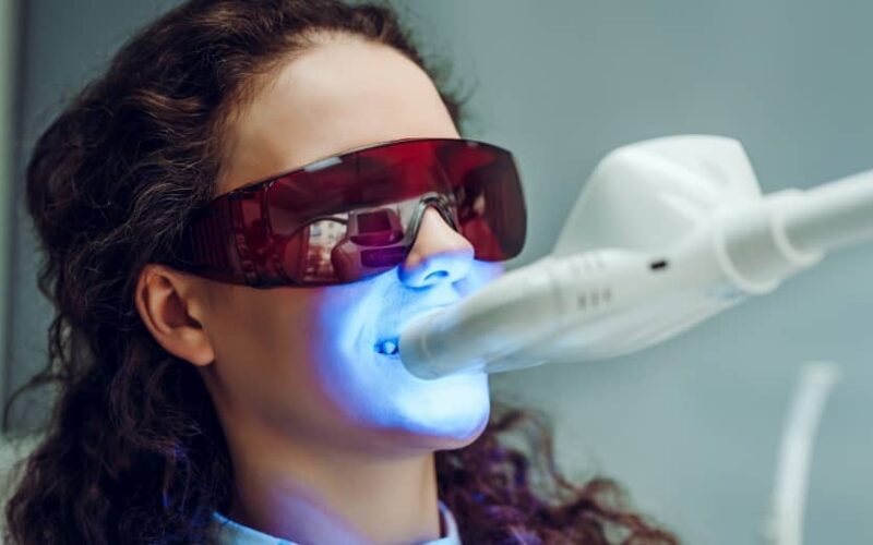 Combien de temps un blanchiment dentaire fait-il effet ? | Dr Elhyani | Paris