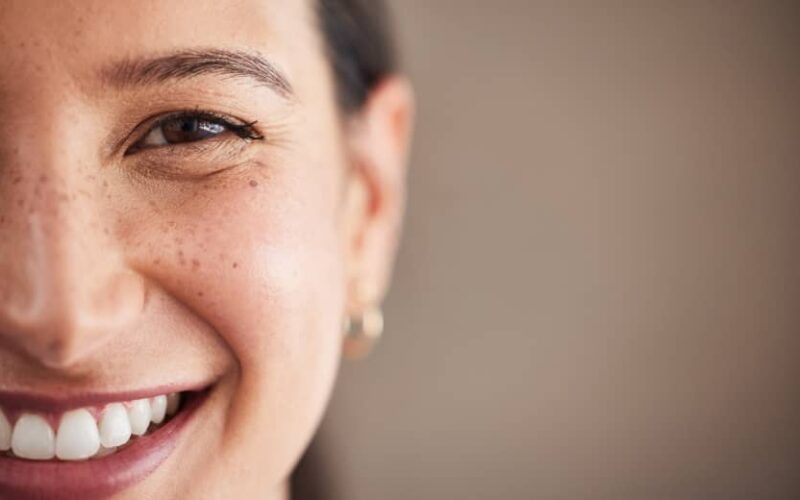 À partir de quel âge peut-on se faire poser des facettes dentaires ? | Dr Elhyani | Paris