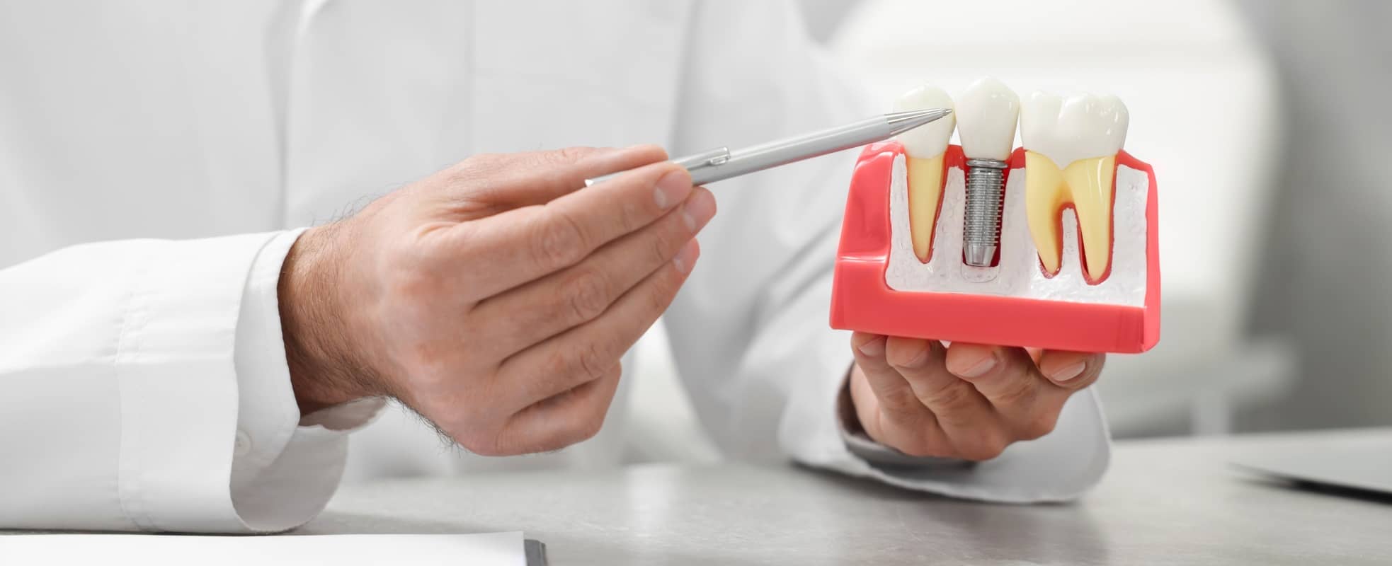 Quels sont les conseils à suivre après une pose d’implants dentaires ? | Dr Elhyani | Paris