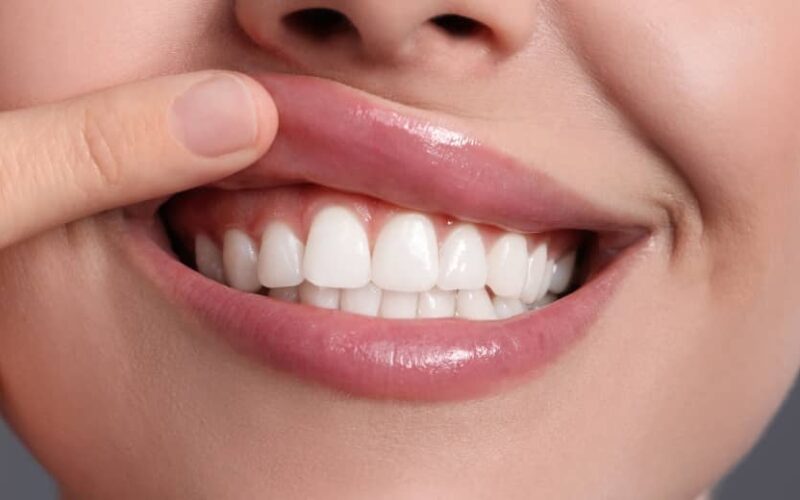 Parodontite : quel traitement ? | Dr Elhyani | Paris