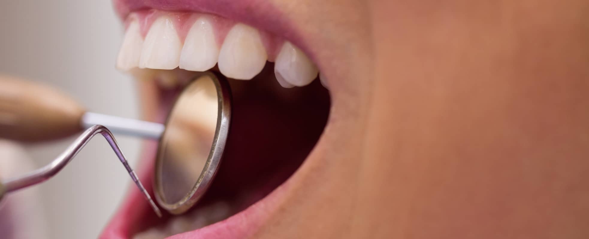 Dent cassée : que faire ? | Dr Elhyani | Paris