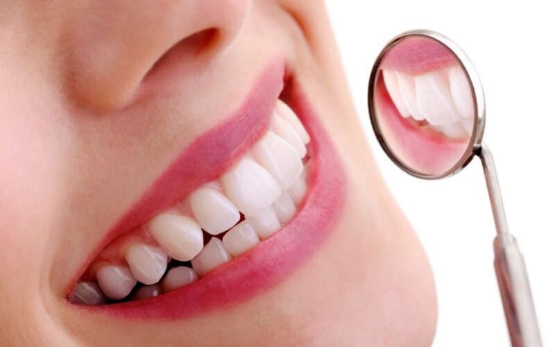 Dangers du blanchiment dentaire : Le Dr Elhyani à Paris vous rassure.