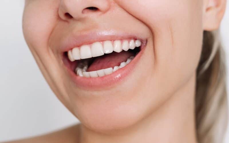 La durée de vie d’une facette dentaire à Paris avec le Dr Elhyani