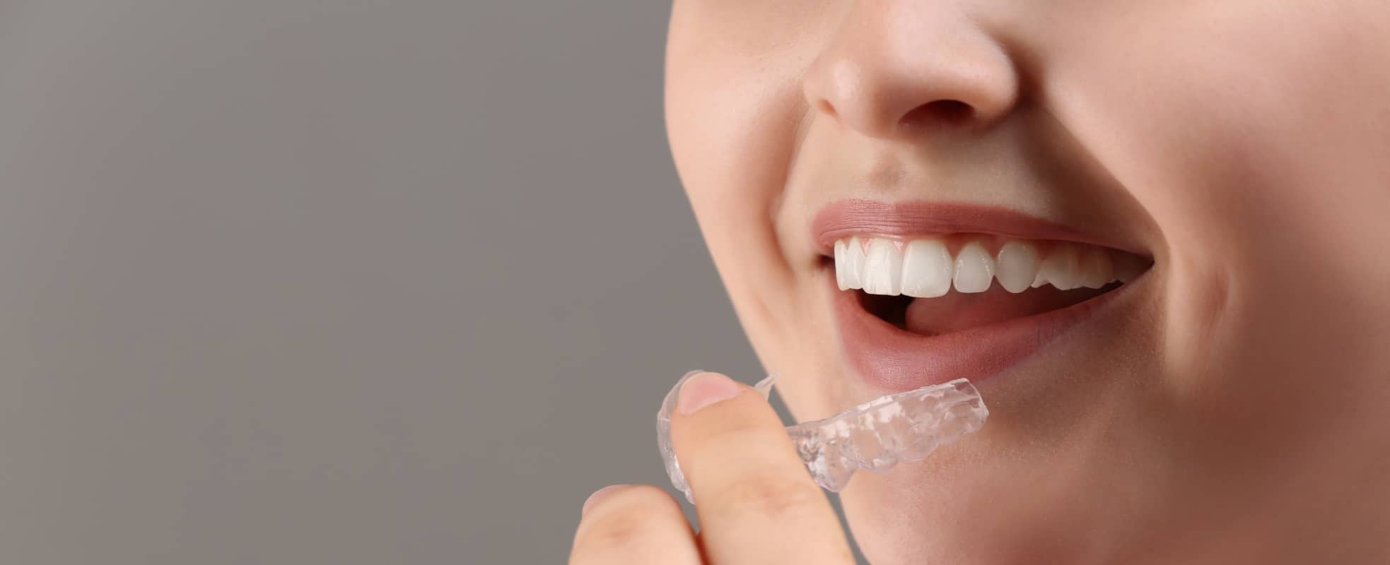 Le Dr Elhyani à Paris vous présente le traitement Invisalign
