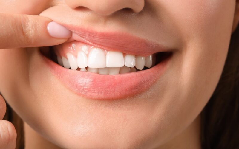 Le Dr Elhyani à Paris vous présente les solutions pour refaire ses dents