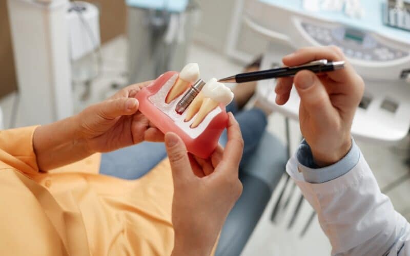 Nombre de séances pour pose implant dentaire