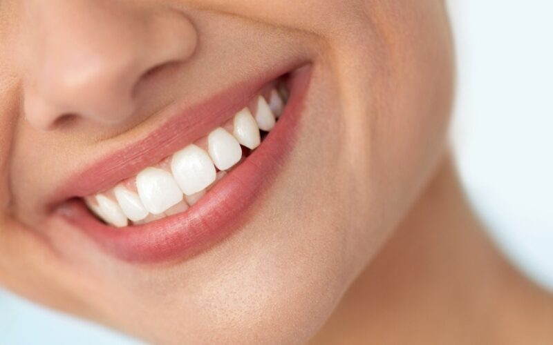 Le Dr Elhyani à Paris vous explique comment réparer les dents usées