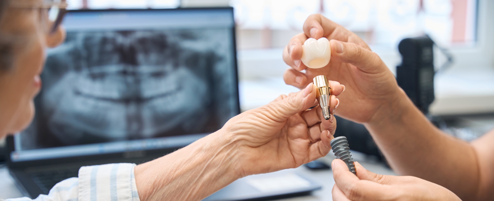 Indications implant dentaire