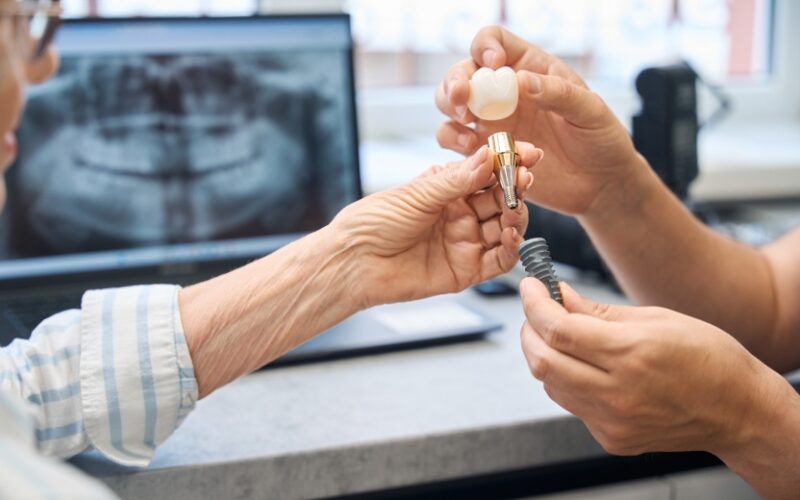 Indications implant dentaire